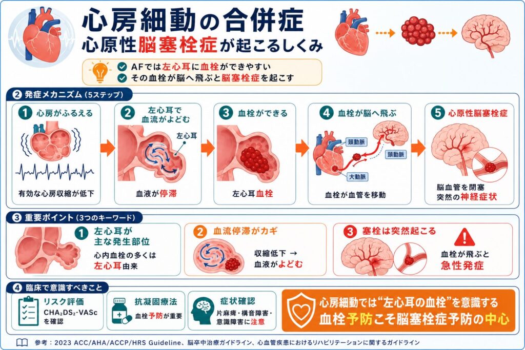 心房細動の合併症:心原性脳塞栓症