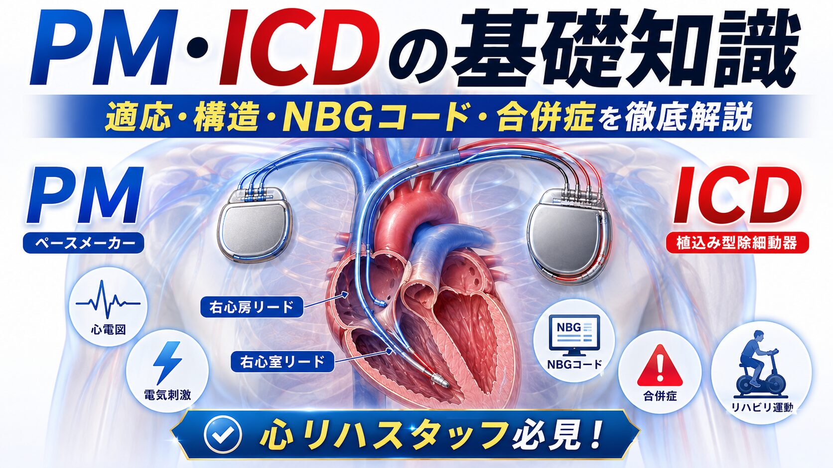 PM・ICDの基礎知識